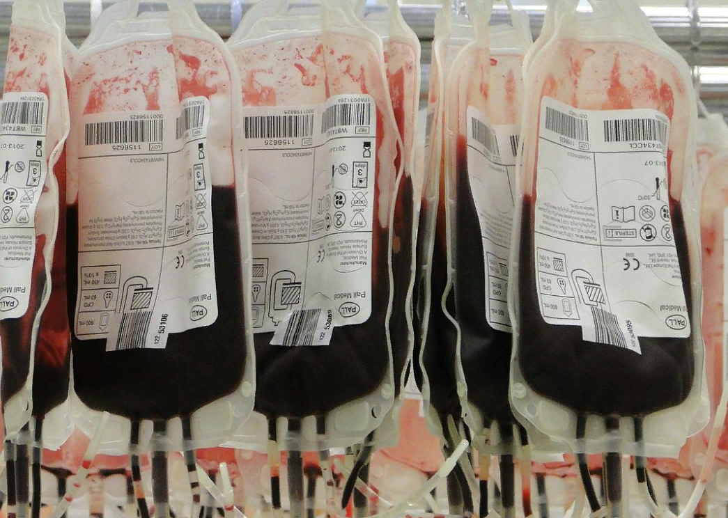 Названа единственная группа крови, обладатели которой предрасположены к раку 