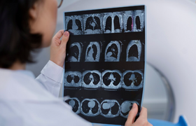 Ученые ДВФУ разработали метод повышения детализ...